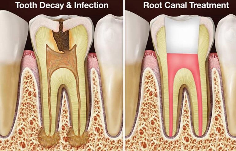 milpitas-square-denta6